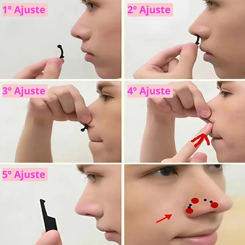 Rinoplastia em 1 Minuto!